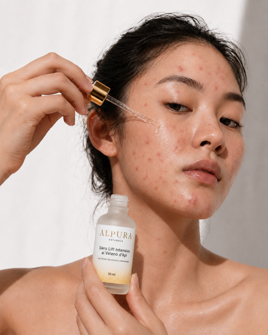 Veleno d’api contro acne e brufoli: siero viso Alpura
