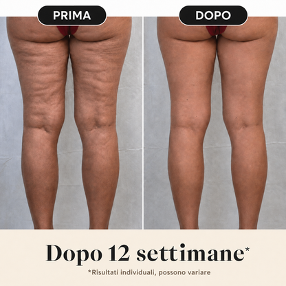 BodyLift – Crema Corpo Intensiva contro gli inestetismi della cellulite