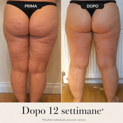 BodyLift – Crema Corpo Intensiva contro gli inestetismi della cellulite